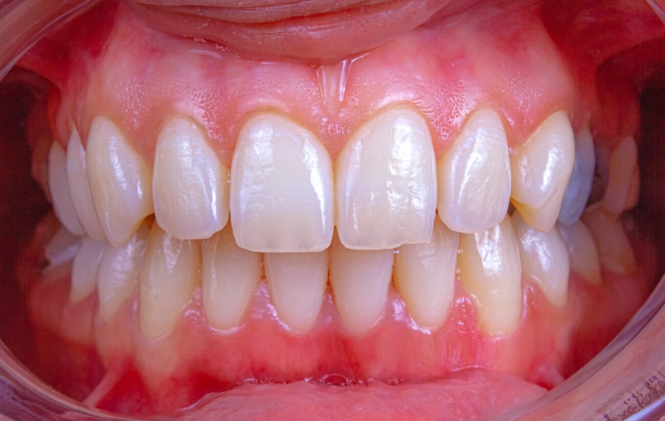 how-to-keep-your-teeth-and-gums-healthy-simple-tips